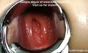 Tình cac dien vien phim sex nhat ban dục với một y tá. Các bệnh viện đối xử với bệnh nhân